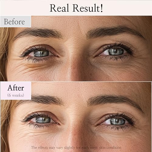 سيروم العيون من مجموعة Beauty of Joseon Revive