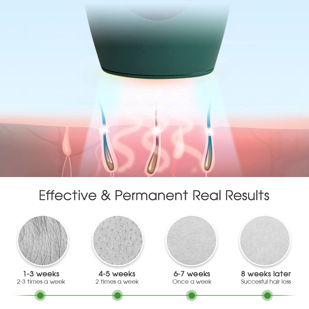 جهاز إزالة الشعر بالليزر الدائم، جهاز إزالة الشعر بالليزر IPL، 900000 ومضة